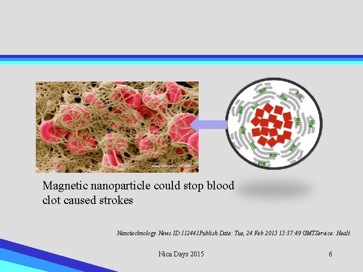 Magnetic nanoparticle could stop blood clot caused strokes Nanotechnology News ID: 112441 Publish Date: