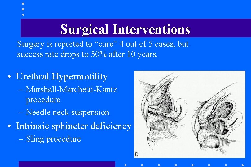 Surgical Interventions Surgery is reported to “cure” 4 out of 5 cases, but success Surgical Interventions Surgery is reported to “cure” 4 out of 5 cases, but success