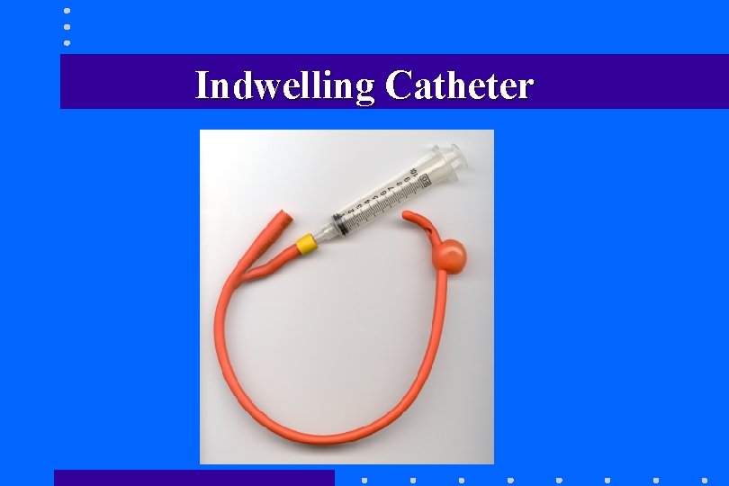 Indwelling Catheter Indwelling Catheter
