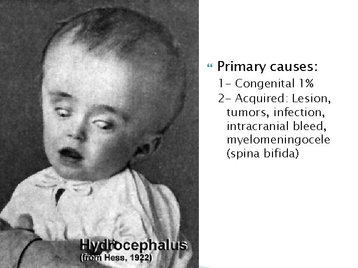  Primary causes: 1 - Congenital 1% 2 - Acquired: Lesion, tumors, infection, intracranial