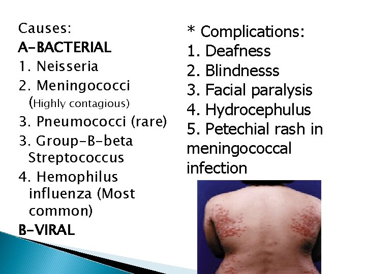 Causes: A-BACTERIAL 1. Neisseria 2. Meningococci (Highly contagious) 3. Pneumococci (rare) 3. Group-B-beta Streptococcus