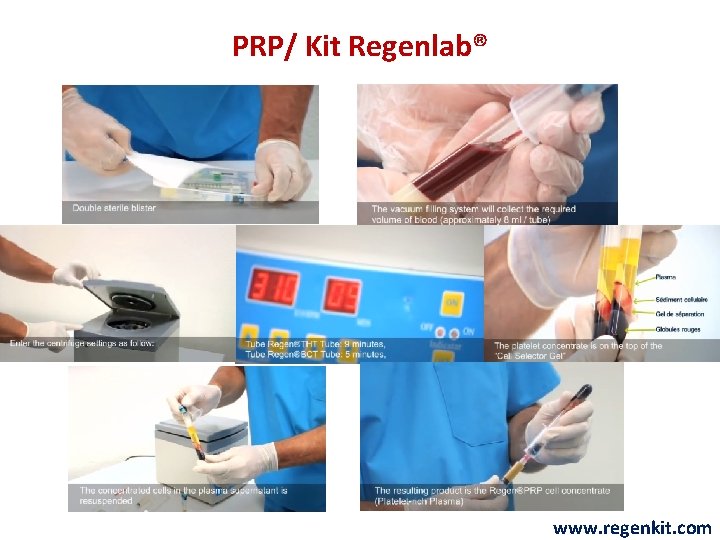 PRP/ Kit Regenlab® www. regenkit. com 