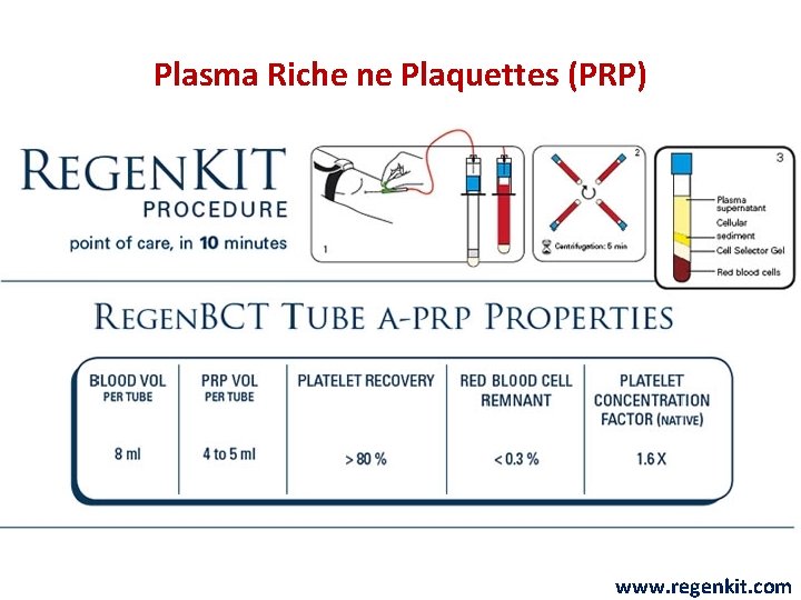 Plasma Riche ne Plaquettes (PRP) www. regenkit. com 
