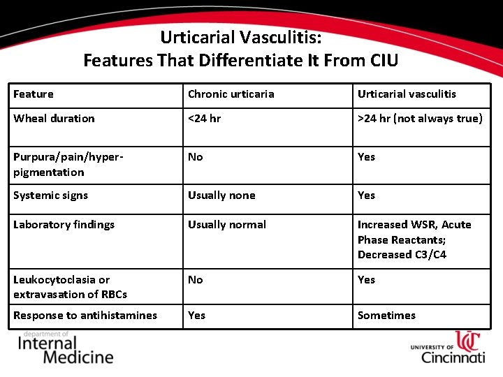 Urticarial Vasculitis: Features That Differentiate It From CIU Feature Chronic urticaria Urticarial vasculitis Wheal