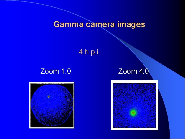 Gamma camera images 4 h p. i. Zoom 1. 0 Zoom 4. 0 