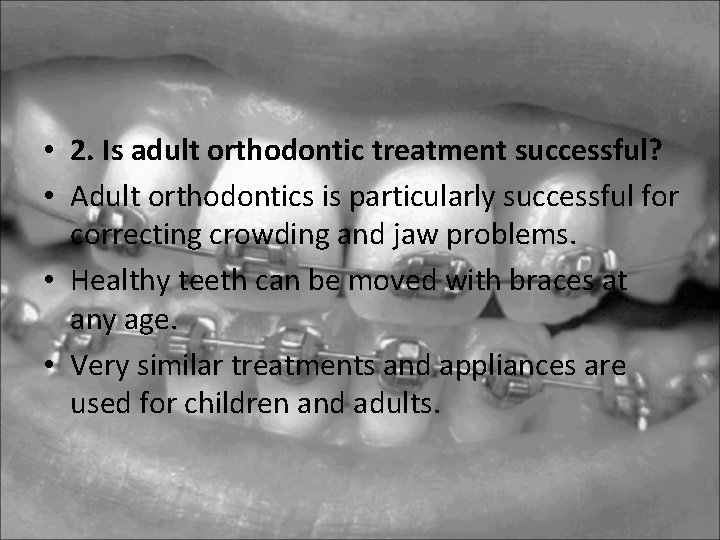 • 2. Is adult orthodontic treatment successful? • Adult orthodontics is particularly successful • 2. Is adult orthodontic treatment successful? • Adult orthodontics is particularly successful