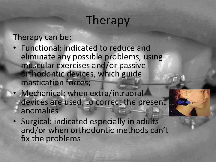 Therapy can be: • Functional: indicated to reduce and eliminate any possible problems, using Therapy can be: • Functional: indicated to reduce and eliminate any possible problems, using