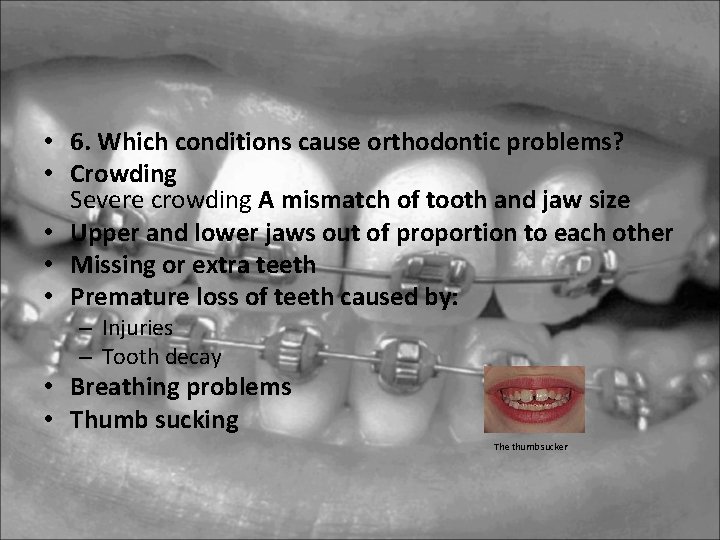 • 6. Which conditions cause orthodontic problems? • Crowding Severe crowding A mismatch • 6. Which conditions cause orthodontic problems? • Crowding Severe crowding A mismatch