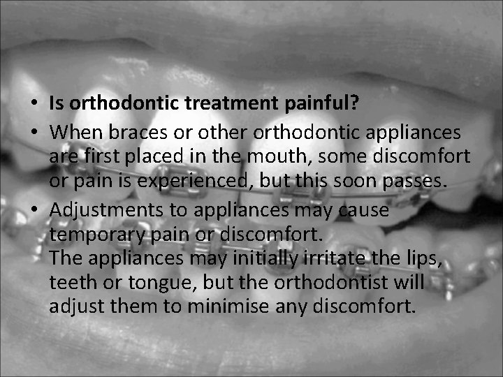 • Is orthodontic treatment painful? • When braces or other orthodontic appliances are • Is orthodontic treatment painful? • When braces or other orthodontic appliances are