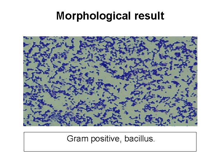Morphological result Gram positive, bacillus. 