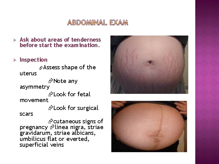 Ø Ask about areas of tenderness before start the examination. Ø Inspection uterus Assess