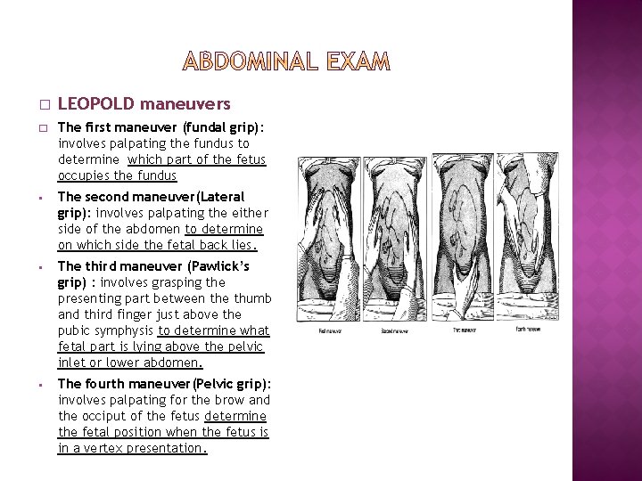 � LEOPOLD maneuvers � The first maneuver (fundal grip): involves palpating the fundus to
