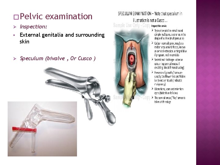 � Pelvic examination Ø Inspection: § External genitalia and surrounding skin Ø Speculum (bivalve