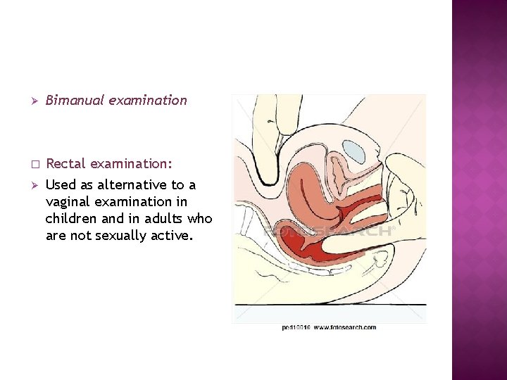 Ø Bimanual examination � Rectal examination: Used as alternative to a vaginal examination in