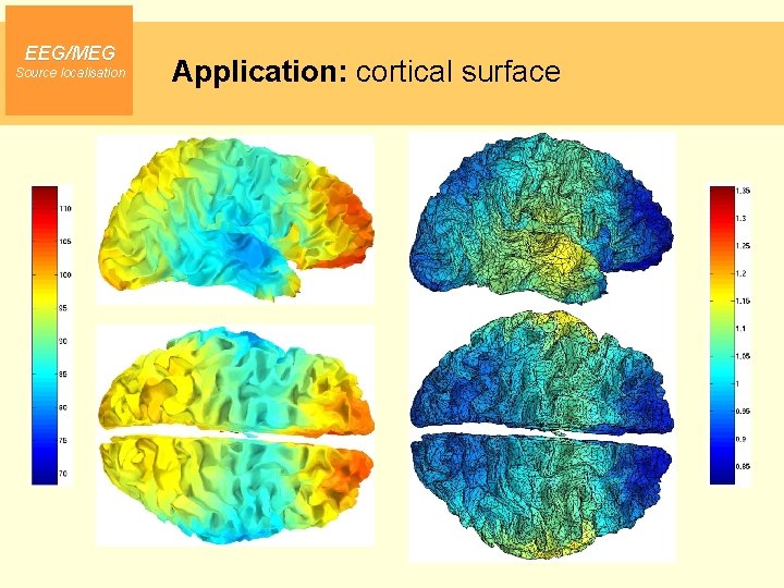 EEG/MEG Source localisation Application: cortical surface 