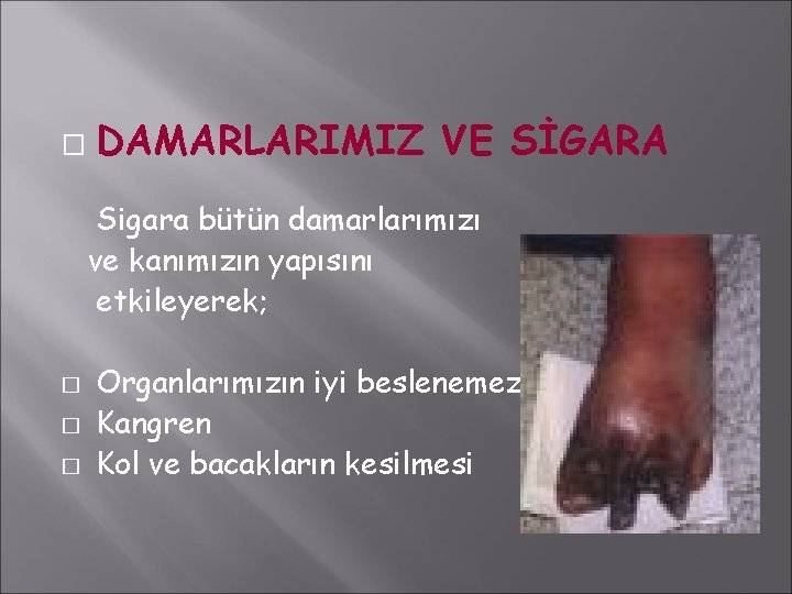 � DAMARLARIMIZ VE SİGARA Sigara bütün damarlarımızı ve kanımızın yapısını etkileyerek; � � �