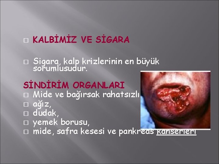 � KALBİMİZ VE SİGARA � Sigara, kalp krizlerinin en büyük sorumlusudur. SİNDİRİM ORGANLARI � � KALBİMİZ VE SİGARA � Sigara, kalp krizlerinin en büyük sorumlusudur. SİNDİRİM ORGANLARI �
