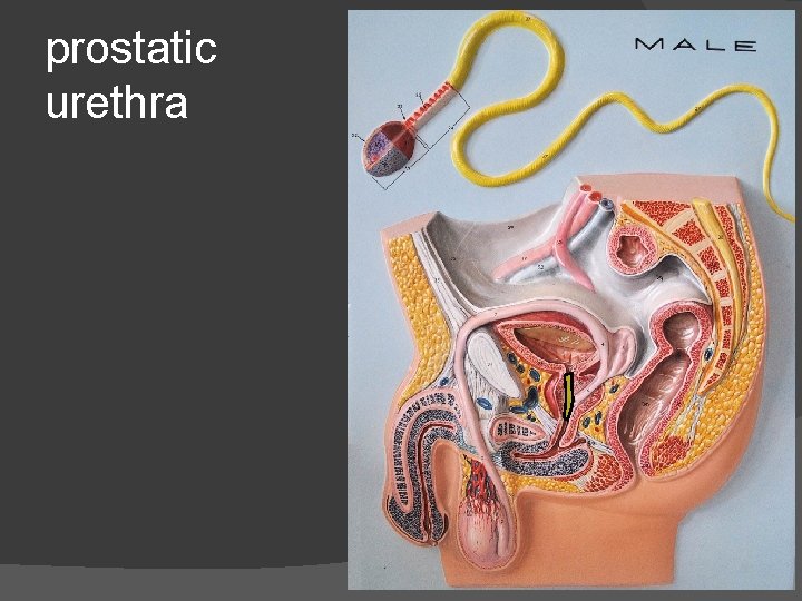 prostatic urethra 