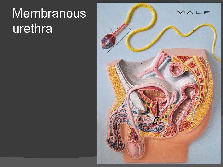 Membranous urethra 