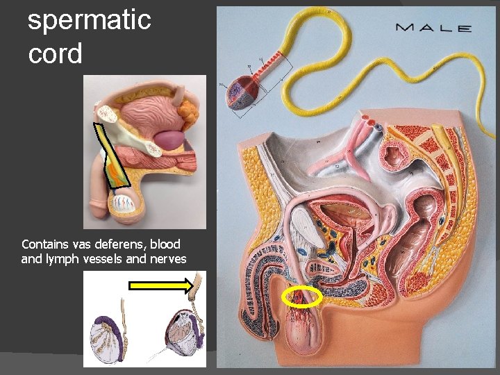 spermatic cord Contains vas deferens, blood and lymph vessels and nerves 