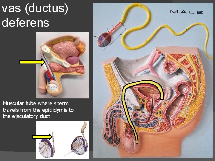 vas (ductus) deferens Muscular tube where sperm travels from the epididymis to the ejaculatory