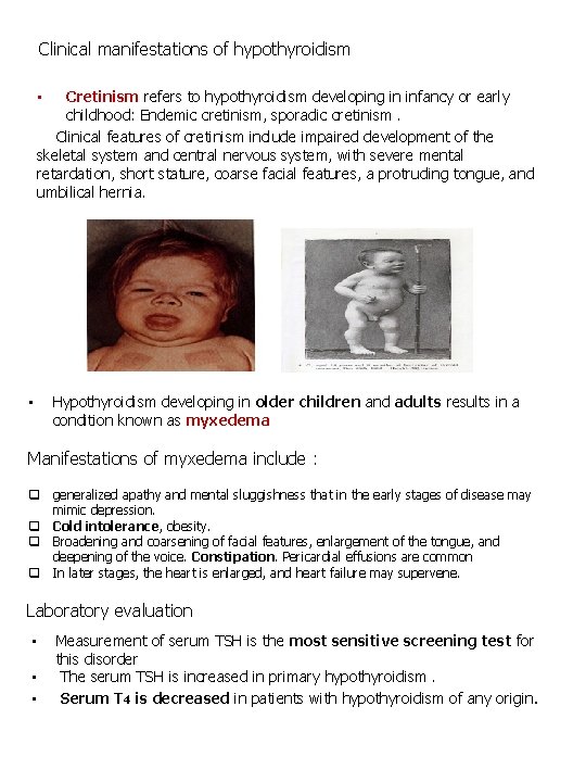 Clinical manifestations of hypothyroidism Cretinism refers to hypothyroidism developing in infancy or early childhood: