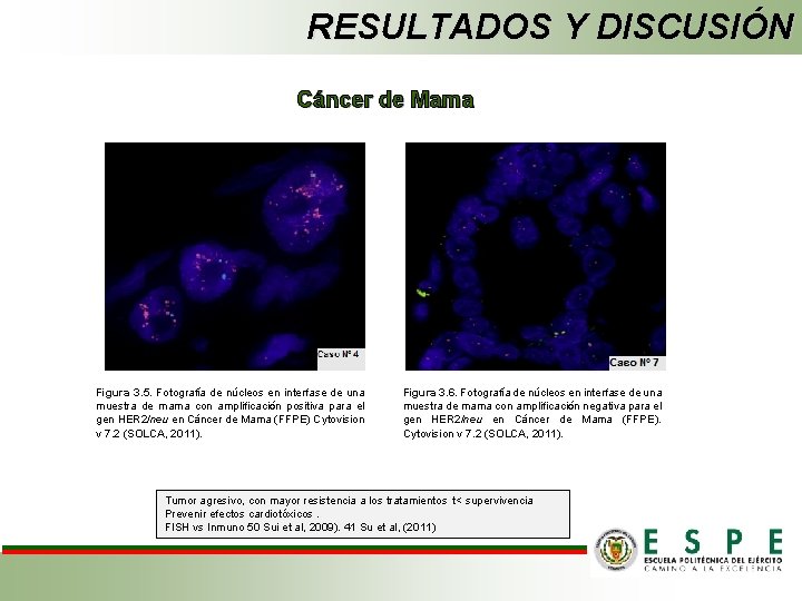 RESULTADOS Y DISCUSIÓN Cáncer de Mama Figura 3. 5. Fotografía de núcleos en interfase