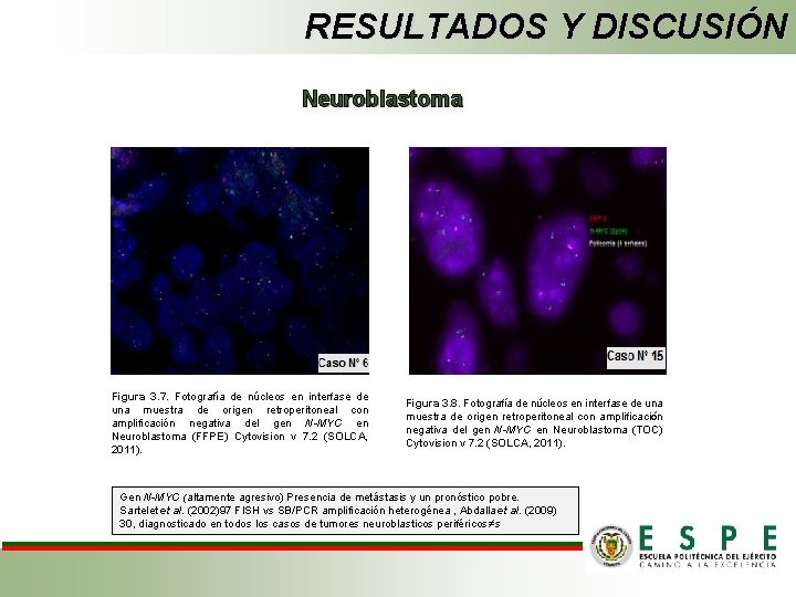 RESULTADOS Y DISCUSIÓN Neuroblastoma Figura 3. 7. Fotografía de núcleos en interfase de una