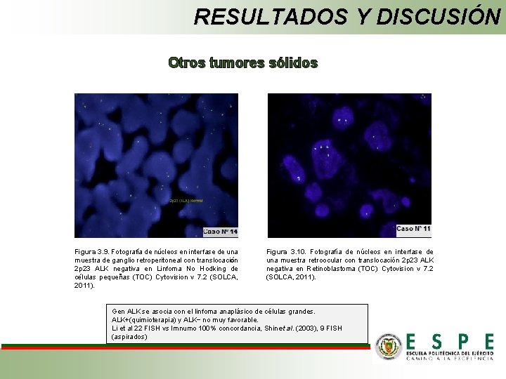 RESULTADOS Y DISCUSIÓN Otros tumores sólidos Figura 3. 9. Fotografía de núcleos en interfase