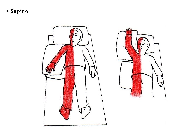 • Supino 