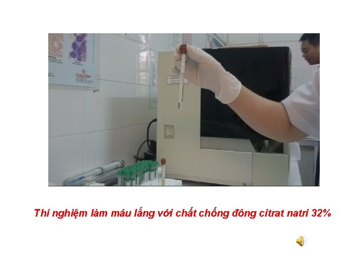 Thí nghiệm làm máu lắng với chất chống đông citrat natri 32% 
