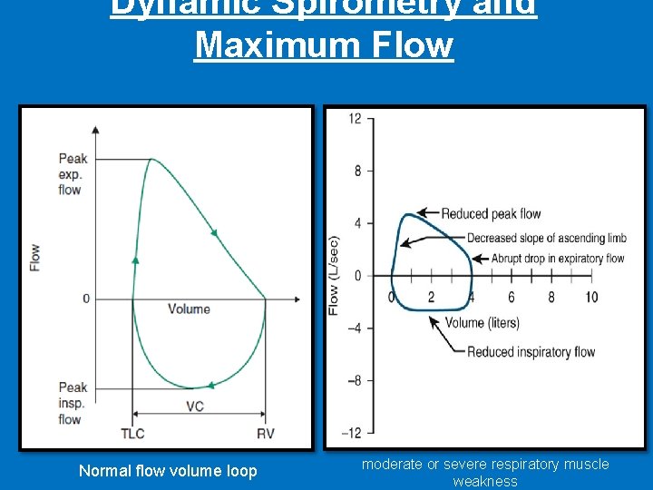 Dynamic Spirometry and Maximum Flow Normal flow volume loop moderate or severe respiratory muscle