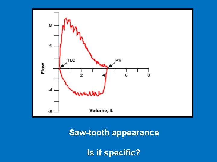 Saw-tooth appearance Is it specific? 