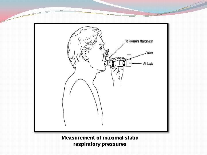 Measurement of maximal static respiratory pressures 