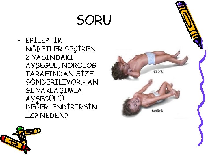 SORU • EPİLEPTİK NÖBETLER GEÇİREN 2 YAŞINDAKİ AYŞEGÜL, NÖROLOG TARAFINDAN SİZE GÖNDERİLİYOR. HAN Gİ