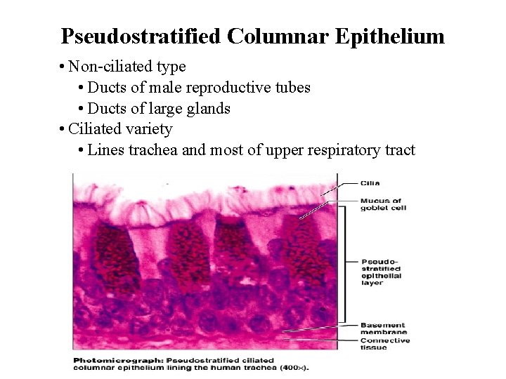 Pseudostratified Columnar Epithelium • Non-ciliated type • Ducts of male reproductive tubes • Ducts
