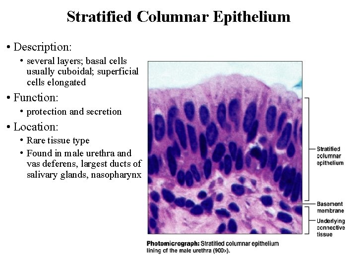 Stratified Columnar Epithelium • Description: • several layers; basal cells usually cuboidal; superficial cells