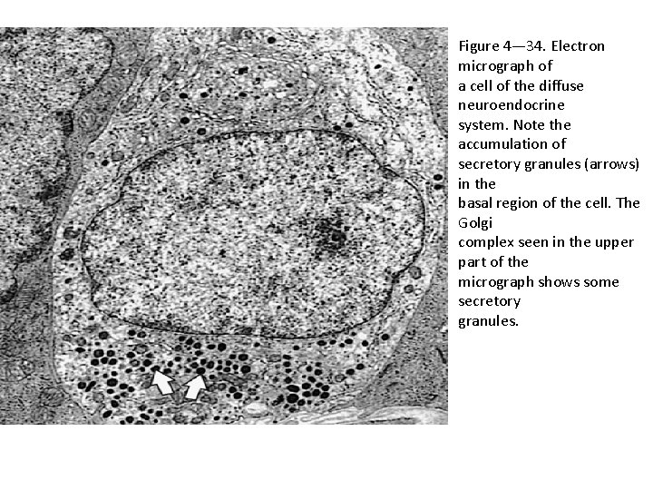 Figure 4— 34. Electron micrograph of a cell of the diffuse neuroendocrine system. Note