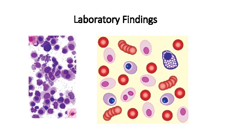 Laboratory Findings 