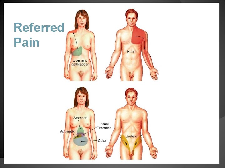 Referred Pain 