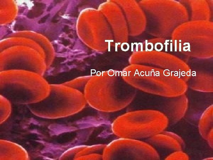 Trombofilia Por Omar Acuña Grajeda 