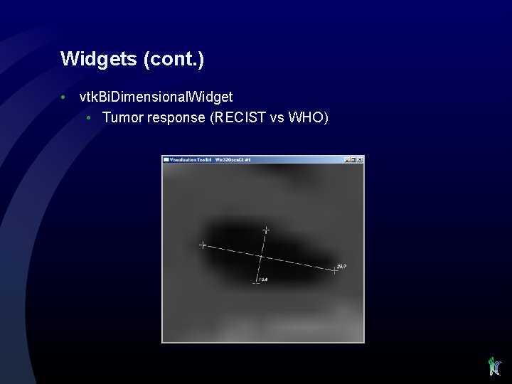 Widgets (cont. ) • vtk. Bi. Dimensional. Widget • Tumor response (RECIST vs WHO)