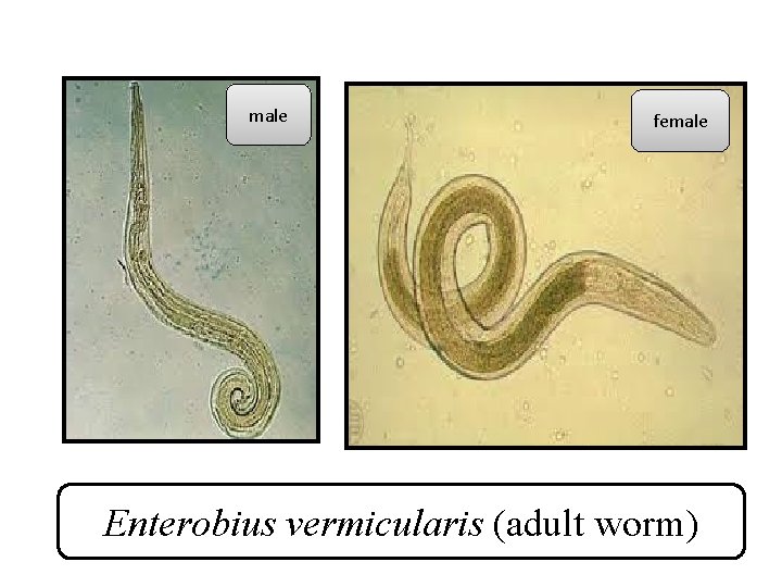Enterobius vermicularis female and male, Enterobius vermicularis nombre comun