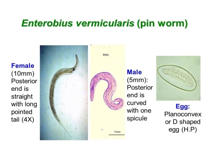 enterobius vermicularis filo)
