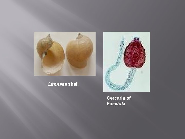 Limnaea shell Cercaria of Fasciola 