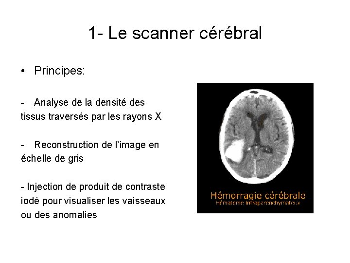 1 - Le scanner cérébral • Principes: - Analyse de la densité des tissus