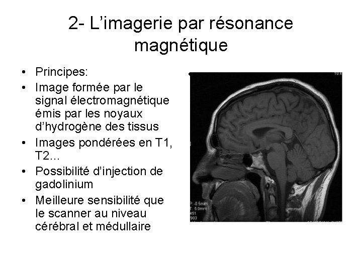 2 - L’imagerie par résonance magnétique • Principes: • • Image formée par le