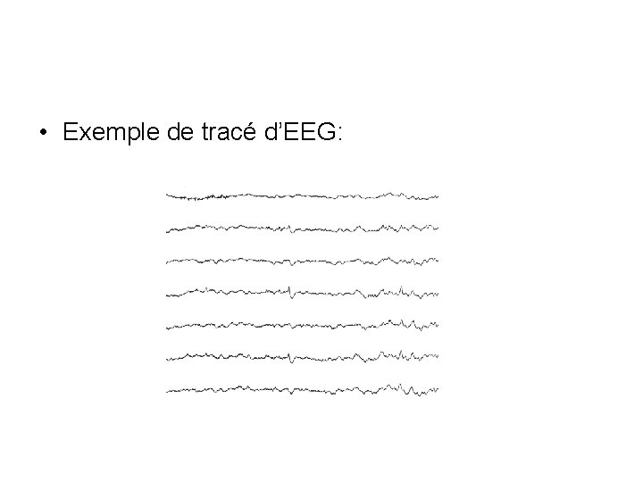  • Exemple de tracé d’EEG: 