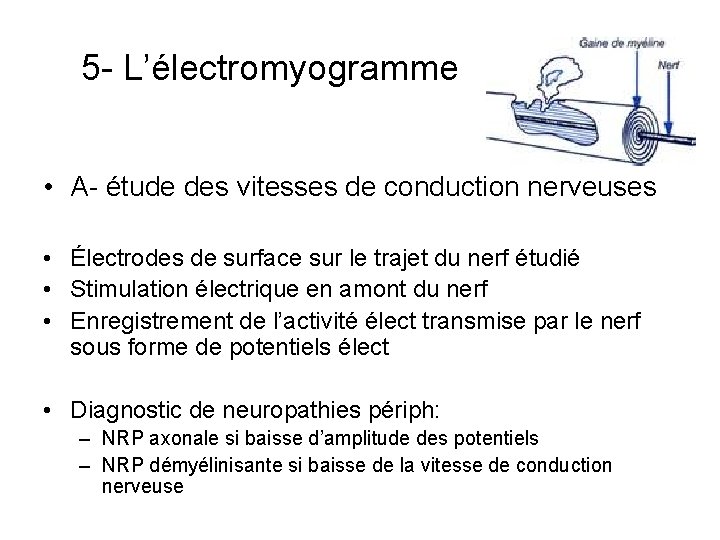 5 - L’électromyogramme • A- étude des vitesses de conduction nerveuses • Électrodes de