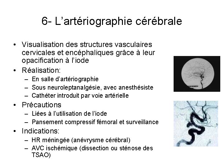 6 - L’artériographie cérébrale • Visualisation des structures vasculaires cervicales et encéphaliques grâce à